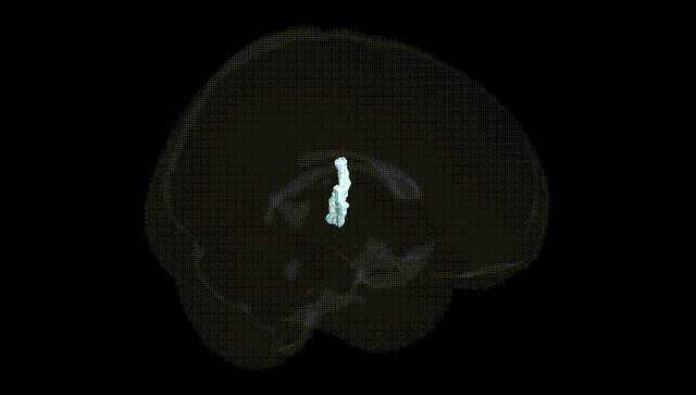 Full Brain Black